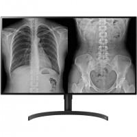 LG 32HL512D-B écran plat de PC 80 cm (31.5") 3840 x 2160 pixels Full HD Noir